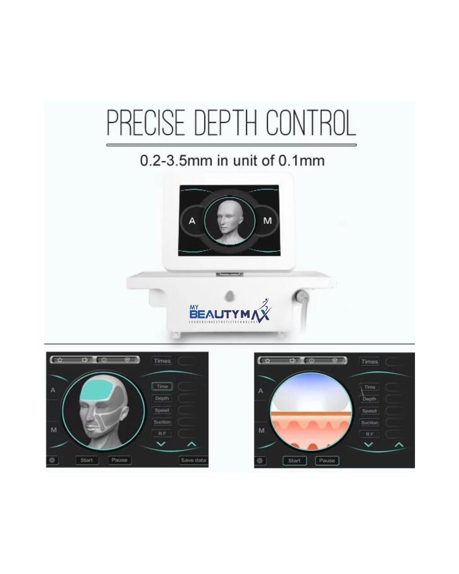 RF Max Fractional