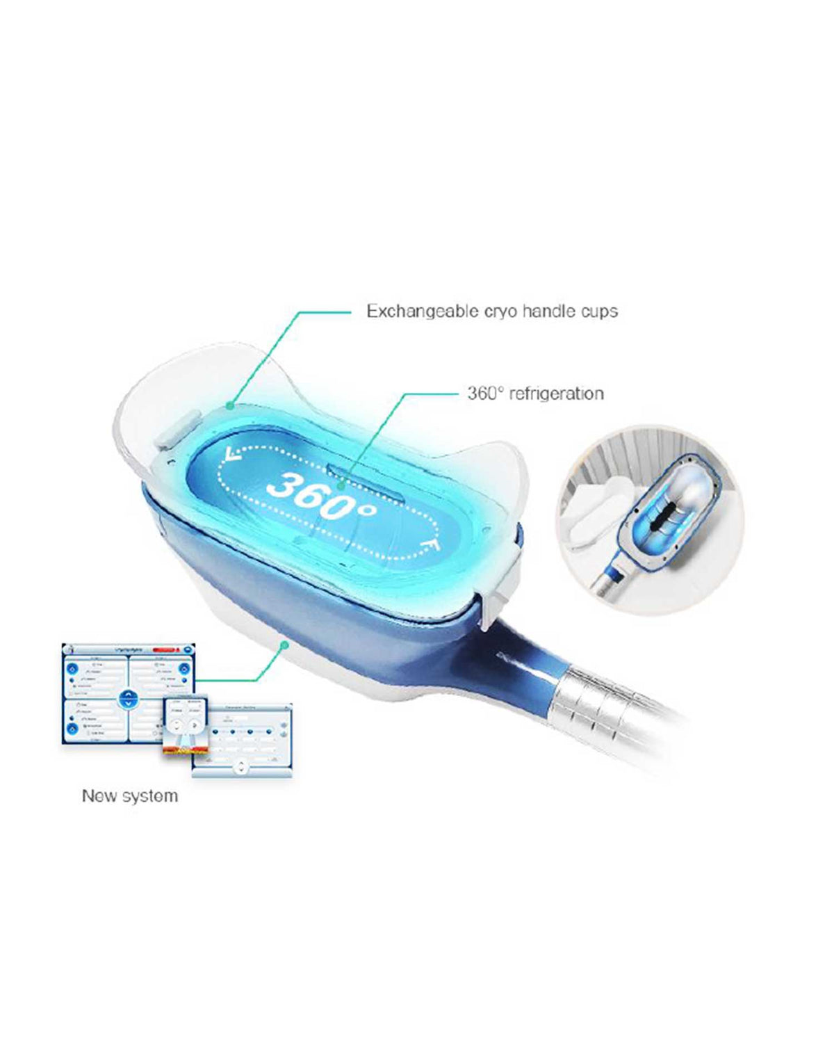360 Angel CryoMax - 2