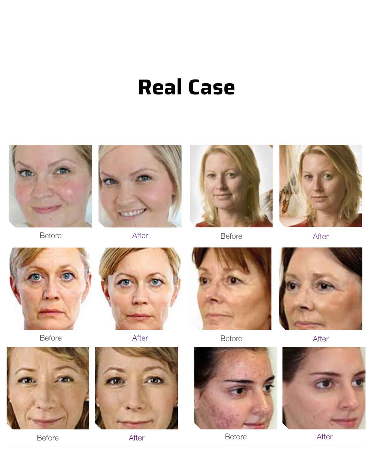 Intelligent LED Oxygen Max facial mask - 8